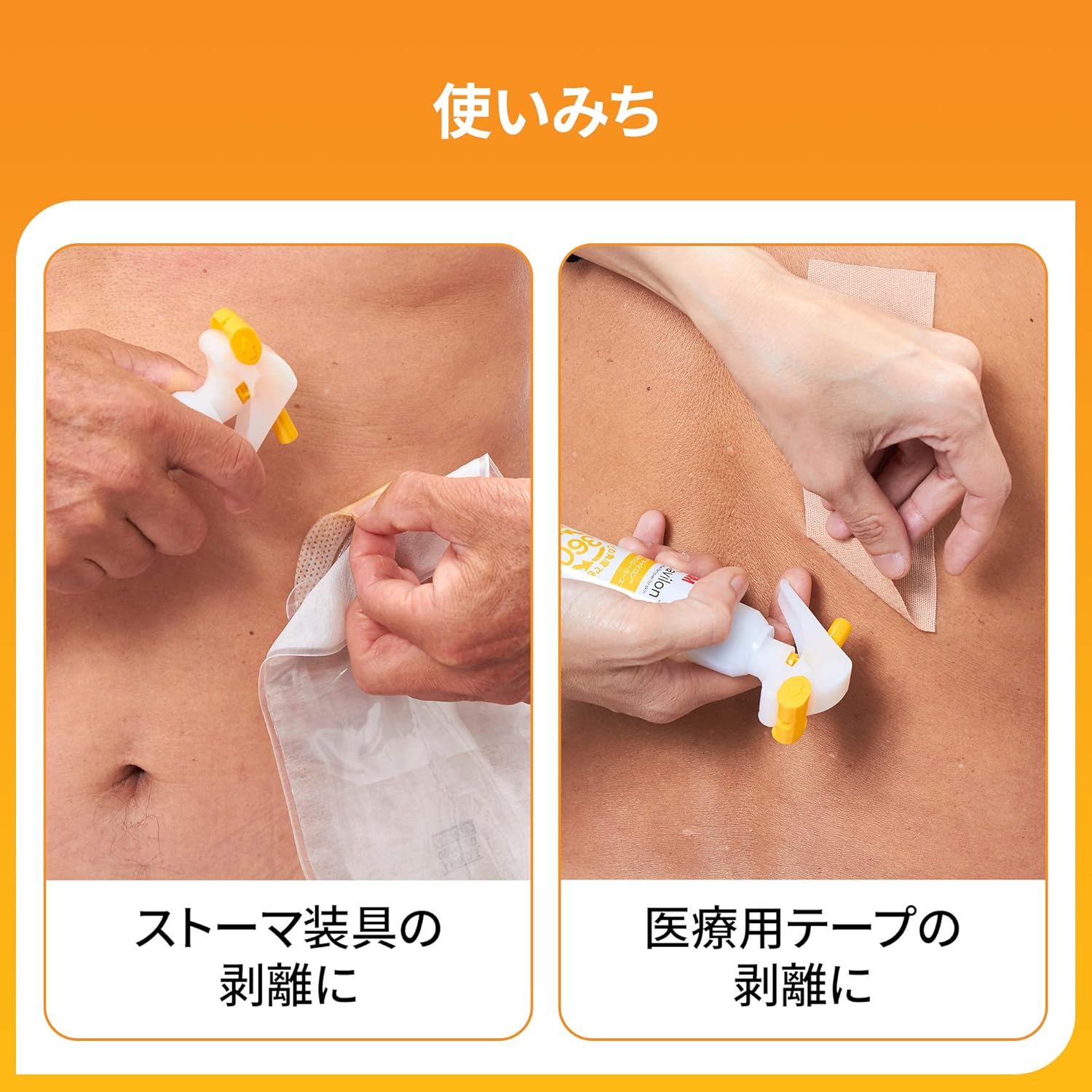 キャビロン　皮膚用リムーバーワイプ